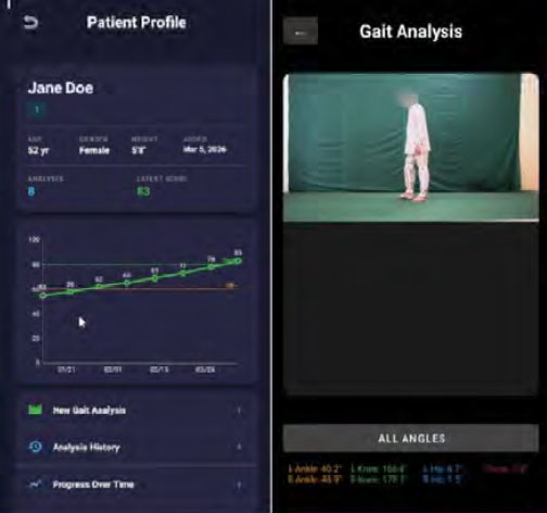 Two phone screenshots showing a patient video and analysis