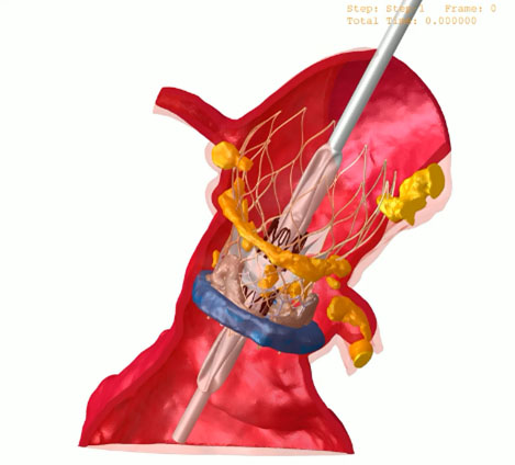 Cardiovascular model