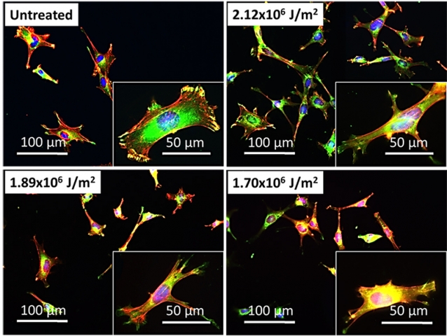Fluorescent images taken for MC3T3-E1 cells adherent on the different substrates after 4 hours, showing focal contacts (green), actin filaments (red) and the nucleus (blue)