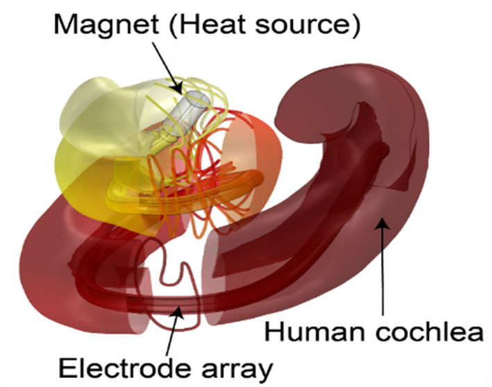 Cochlea with magnet as heat source