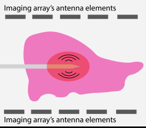 Imaging array's antenna elements