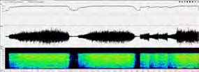 Acoustic noise and imaging data processing