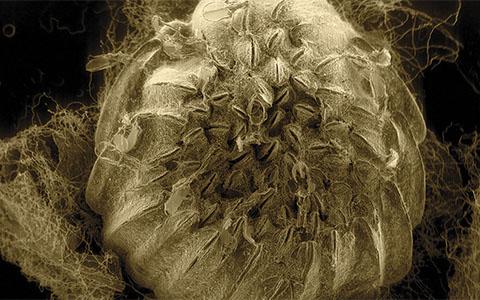 Highly magnified electron microscope image of phylloxera galls